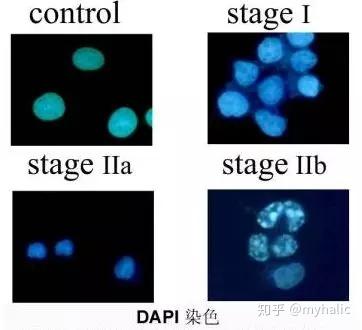 细胞中晚期凋亡检测 知乎