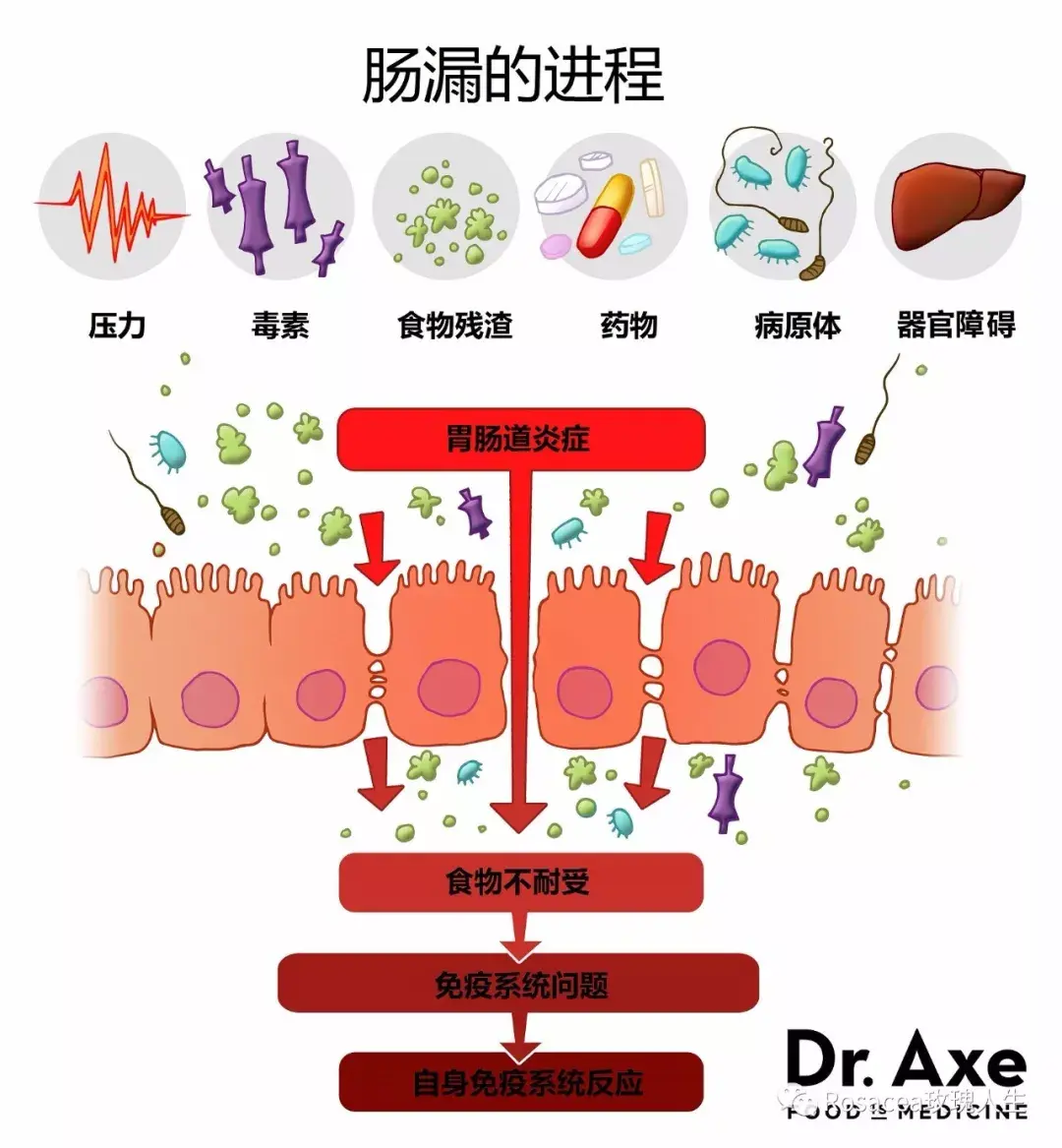 玫瑰痤瘡與腸漏綜合徵