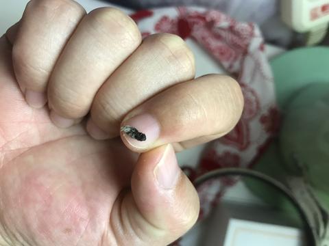 有天洗澡完,开始抹防妊娠纹的油,抹来抹去,觉得那个硬硬的东西越来越