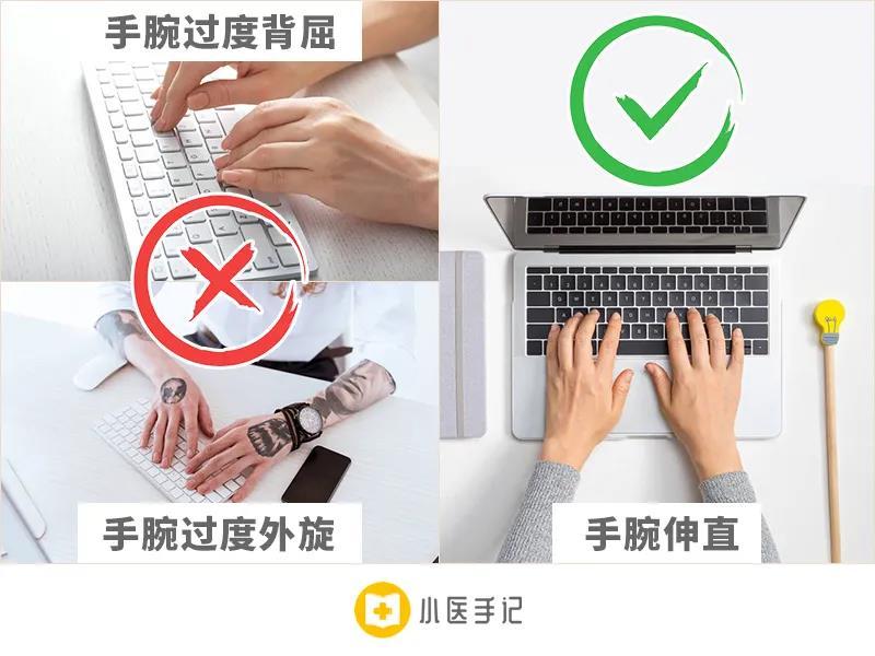 腕管综合征六招轻松缓解鼠标手