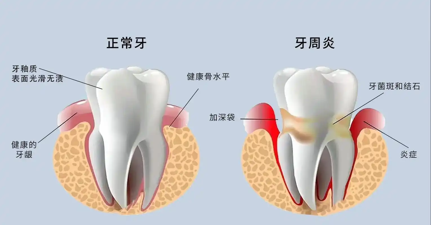 牙齿在伤情鉴定中的一些问题 - 知乎