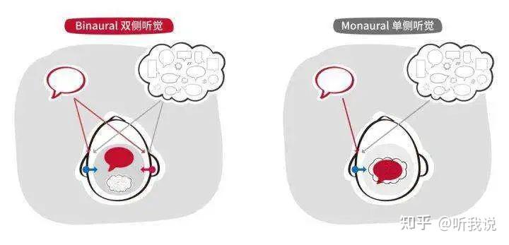 单单侧聋（SSD）的病因与影响 - 知乎