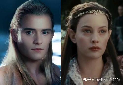什么样的精灵耳最好 v2-728baa39bb64b1f29a6560547a4fdd18_r.jpg