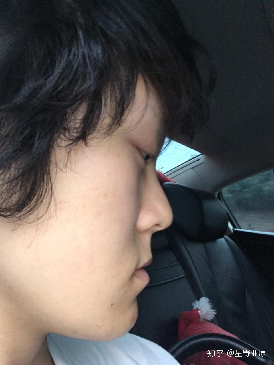 正脸好看但侧脸丑到爆是种怎样的体验? - 知乎