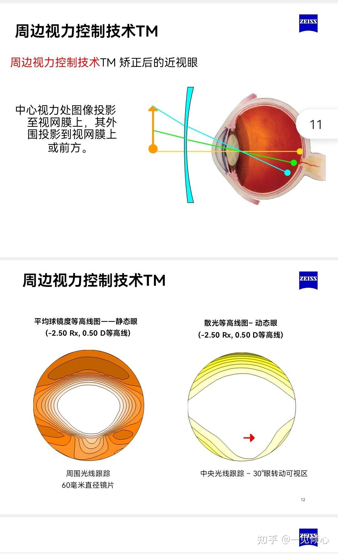 成长乐镜片原理图片