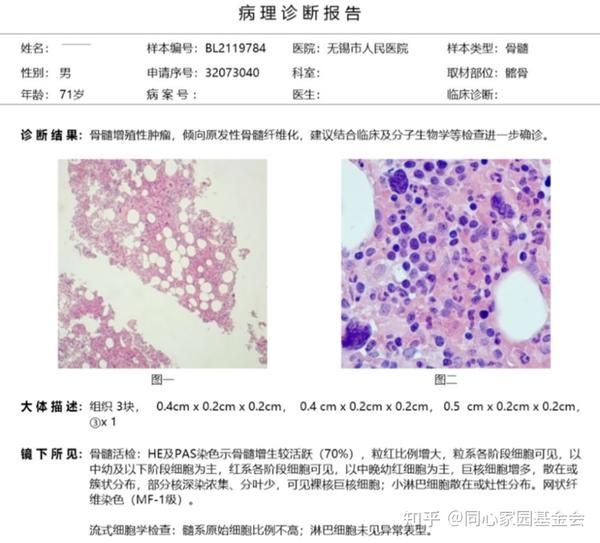吃饺子谁发明的