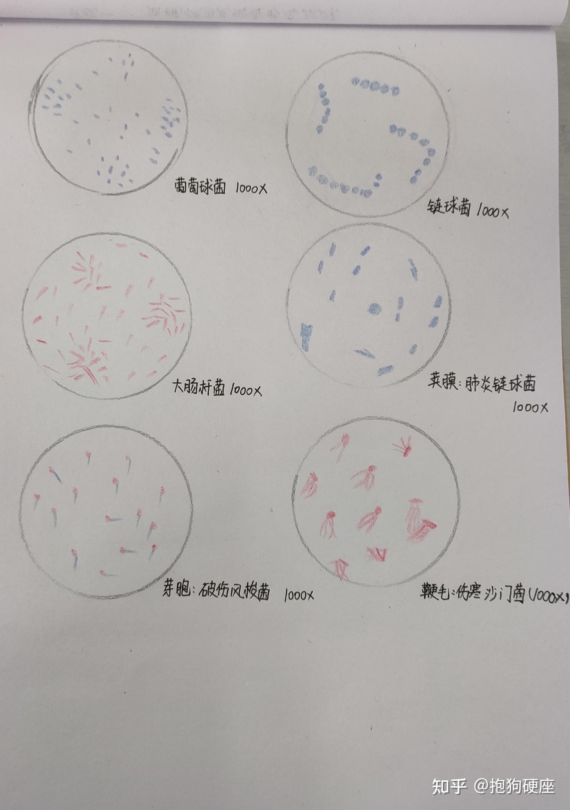 肺炎双球菌芽孢手绘图图片