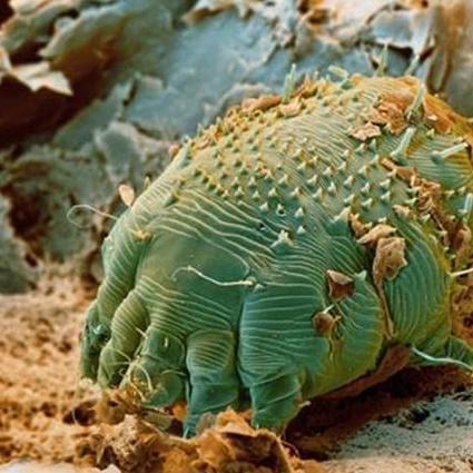 管理百科讨论精华视频等待回答简介疥螨(jie man)属真螨目,疥螨科