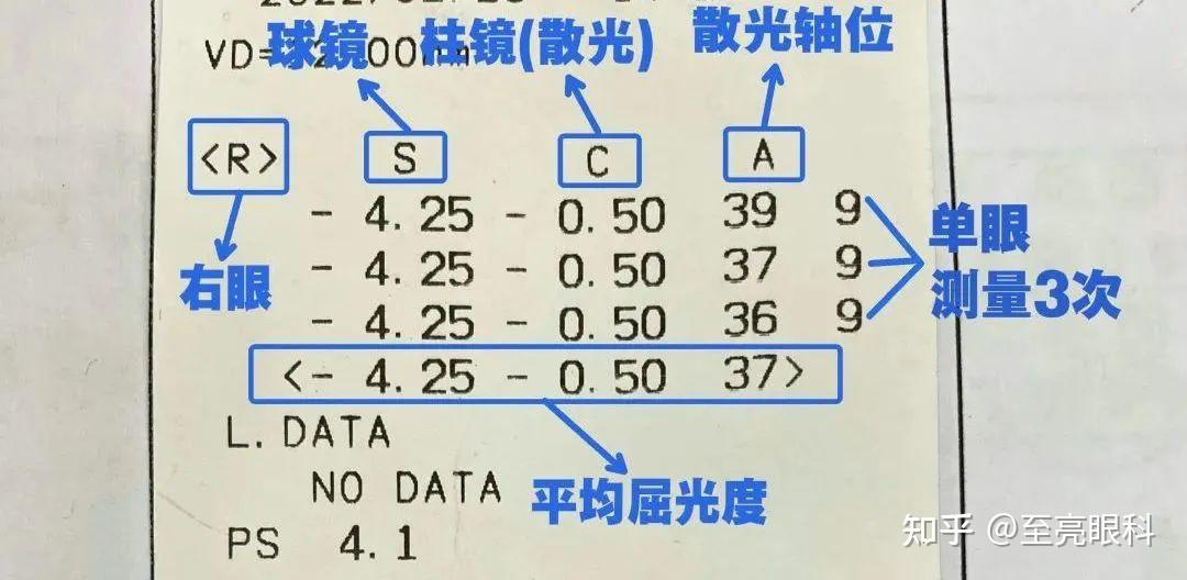 10秒看懂电脑验光单,找准这几个参数即可! - 知乎
