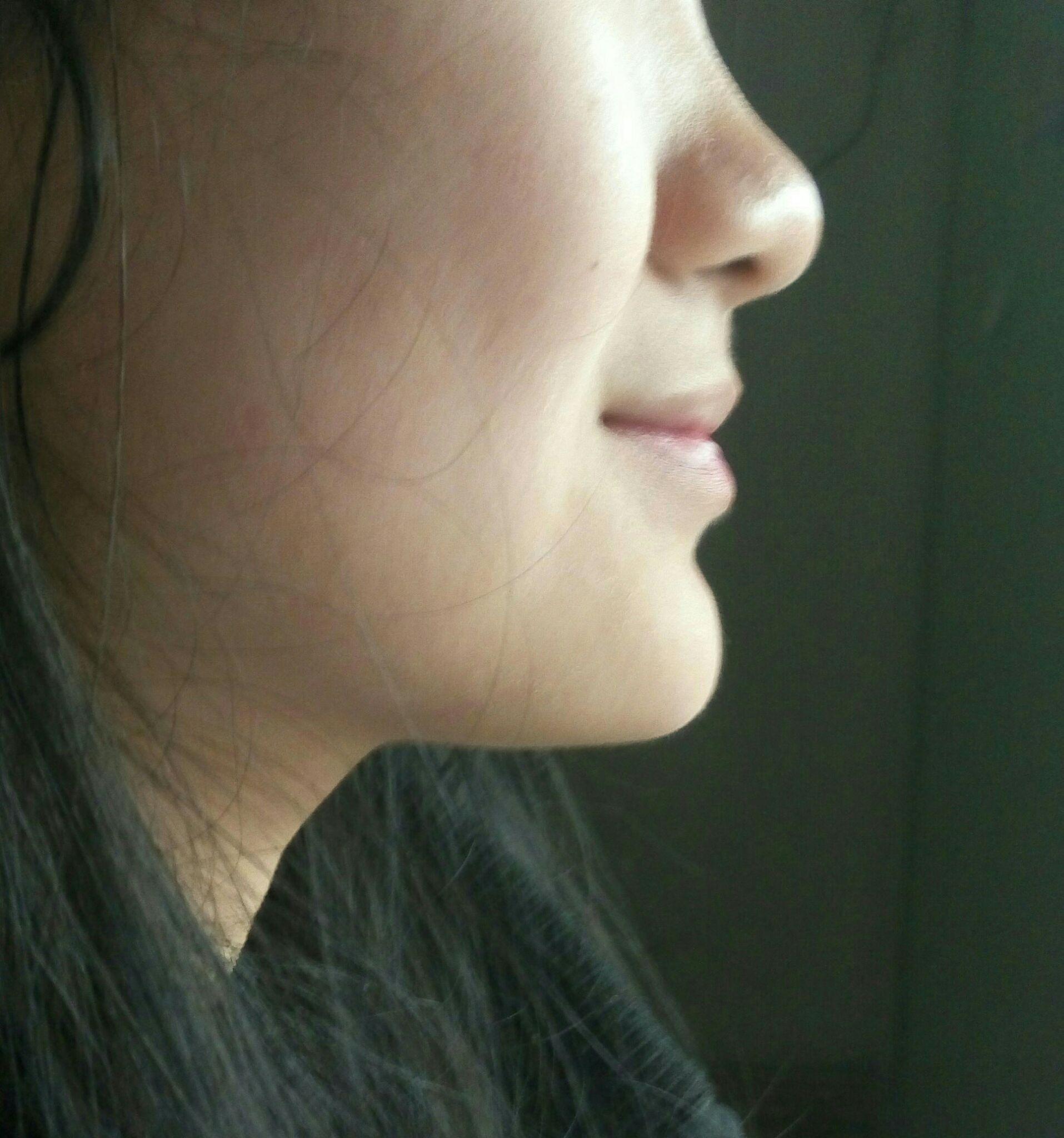 下巴肉多怎么办