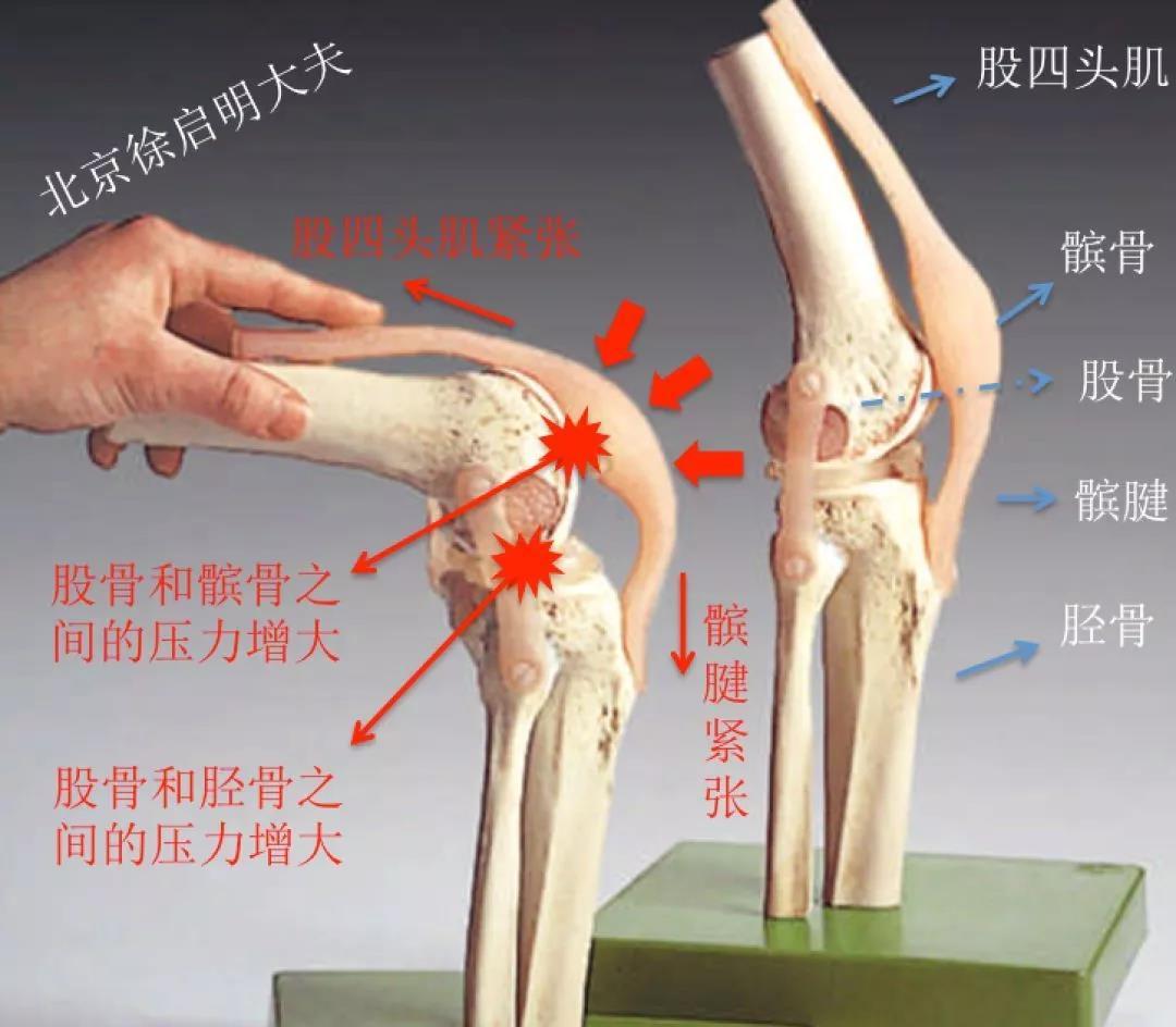 膝关节应用解剖及手术入路，详细解析！ - 好医术早读文章 - 好医术-赋能医生守护生命