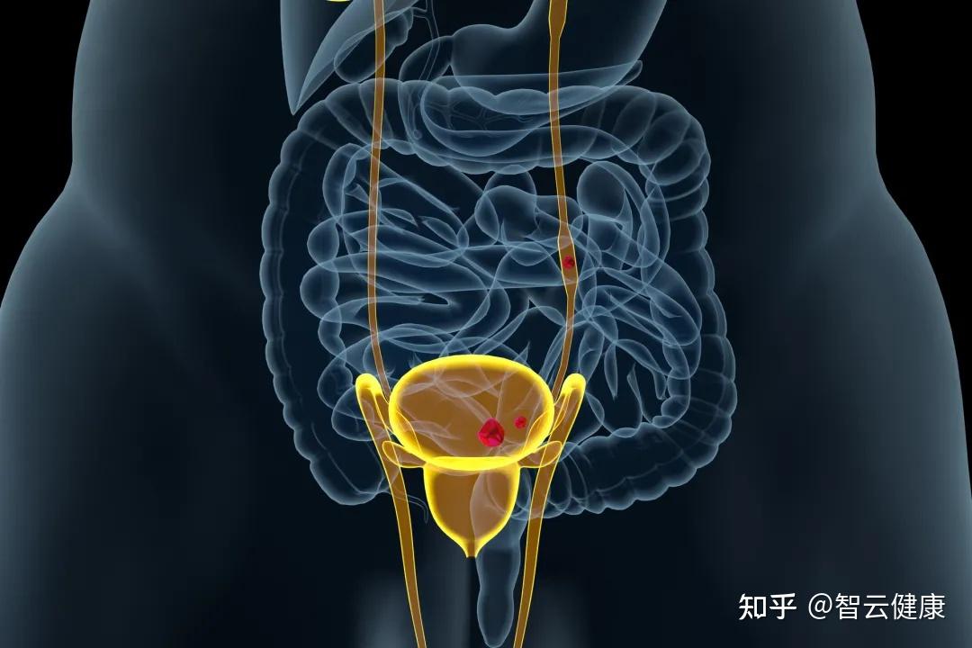 這是因為尿液在經由腎臟後,會通過輸尿管,膀胱及尿道,最後排出體外.