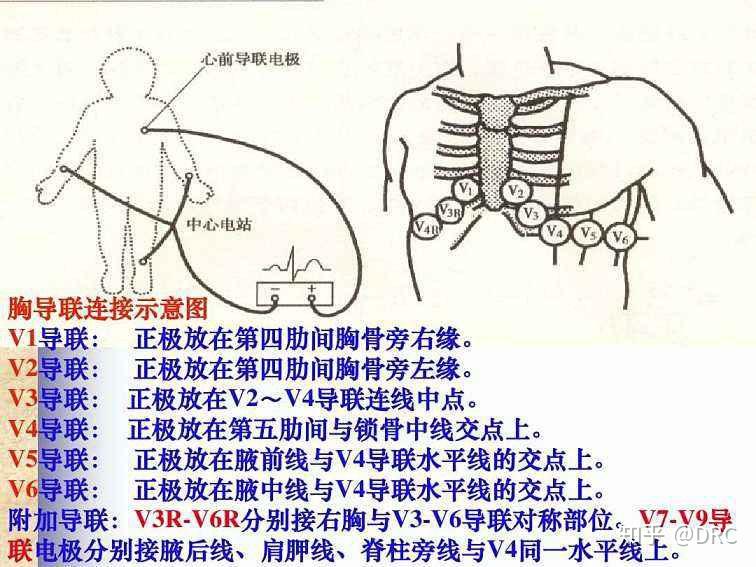 八导联心电图机准确吗?