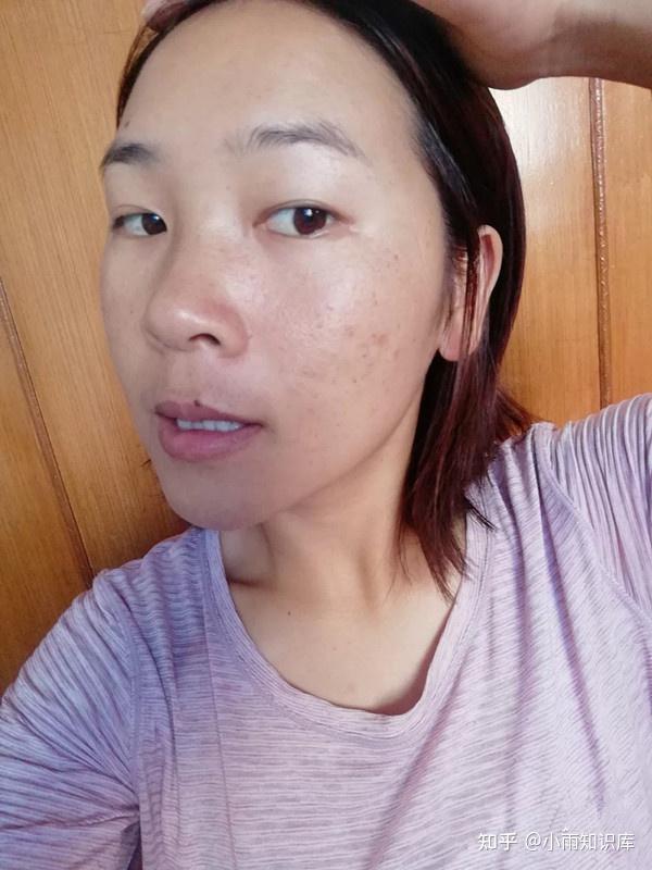 无光,色素沉重,色斑,冒痘,出油等等脸部皮肤问题,都是皮肤早衰的症状