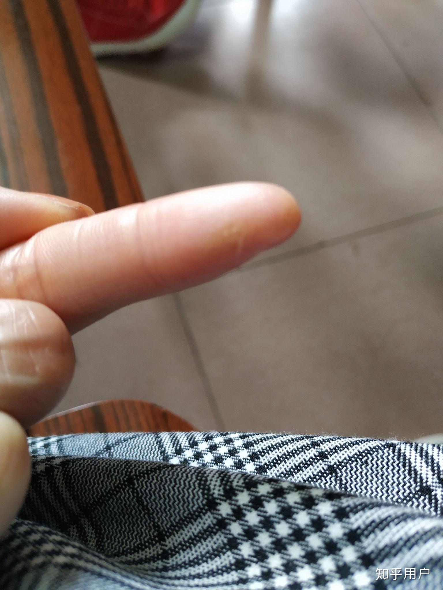 壁虎有毒吗主要要注意它的什么东西有毒皮肤尿液血还是其他