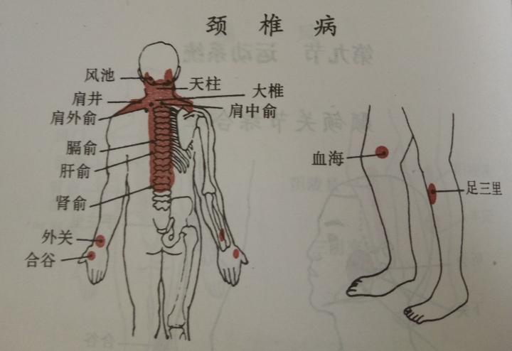 养生灸之六大强壮穴,你了解吗? - 知乎