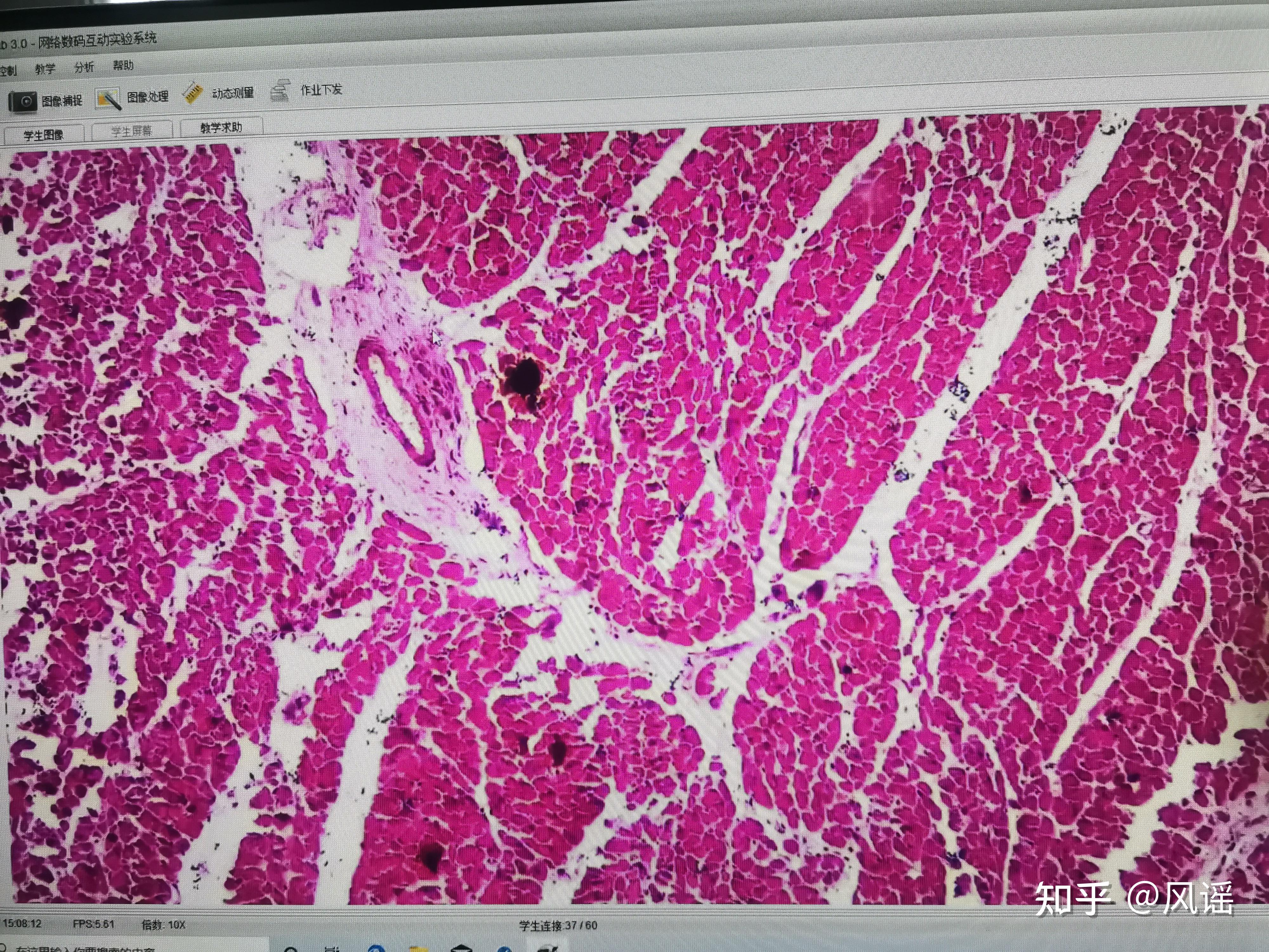 病理学实验切片和病变特点