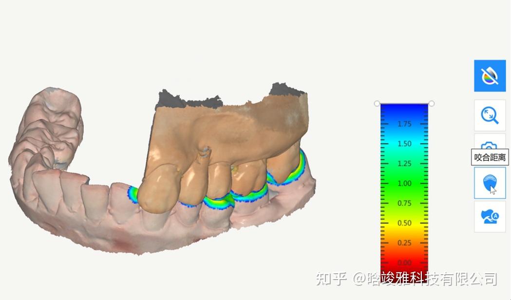 口扫有哪些智能工具 - 知乎