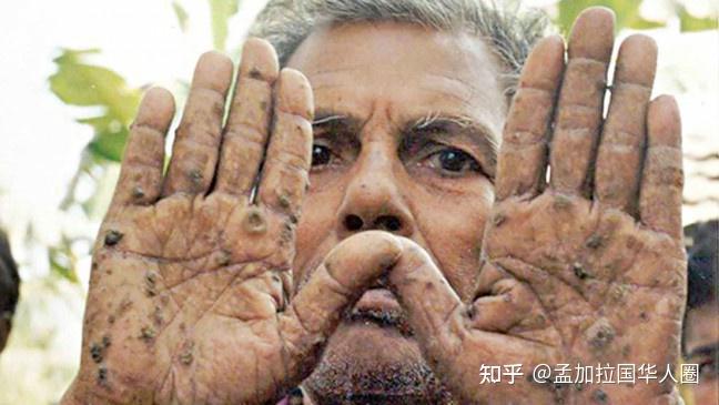 孟加拉国水中的砷污染多年来没有进行过适当的研究