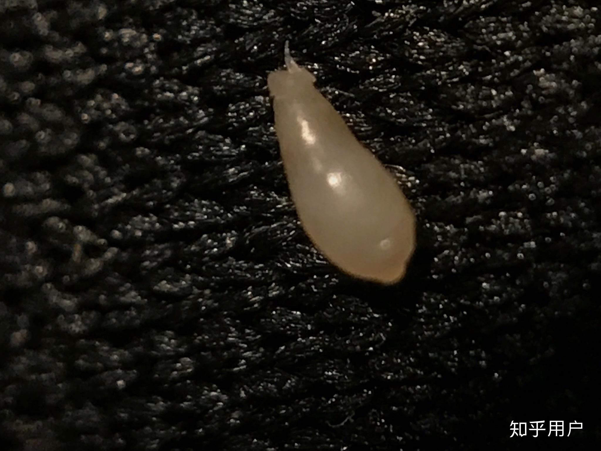 痘痘里面挤出来的小米粒是什么? - 知乎