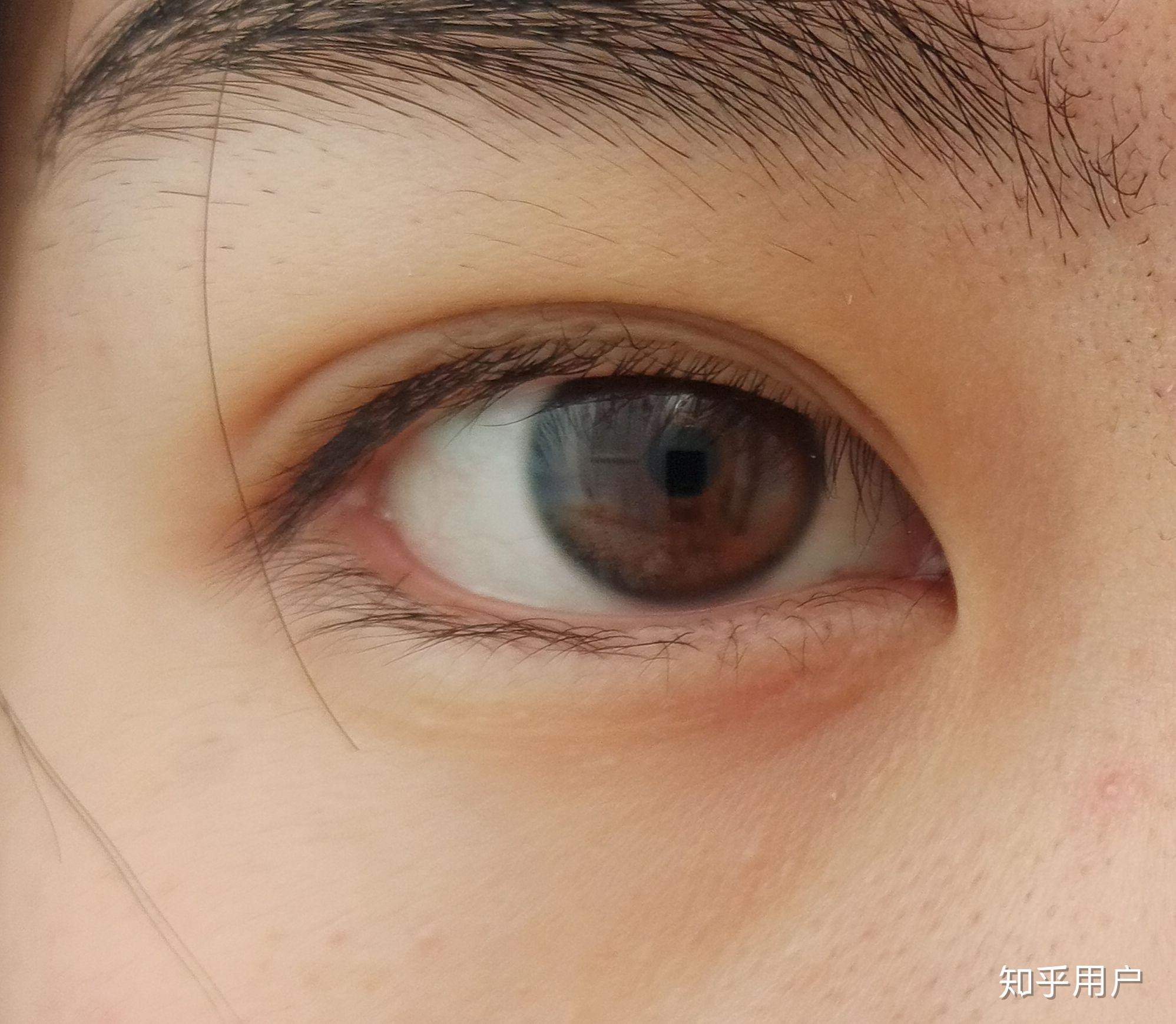 女生有双好看的眼睛是什么体验