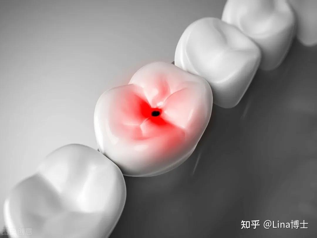 牙齿咬东西酸痛怎么办（吃东西牙齿酸软，要警惕这5种牙病） | 说明书网