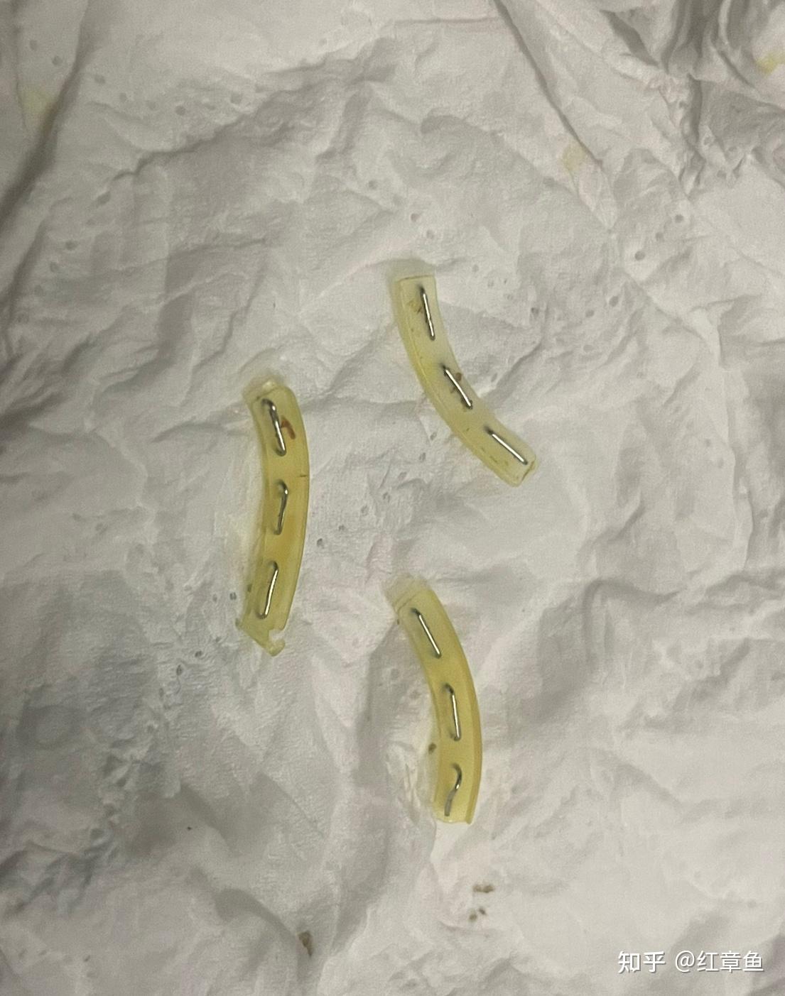 分享一下我个人的包皮环切术后恢复过程 - 知乎