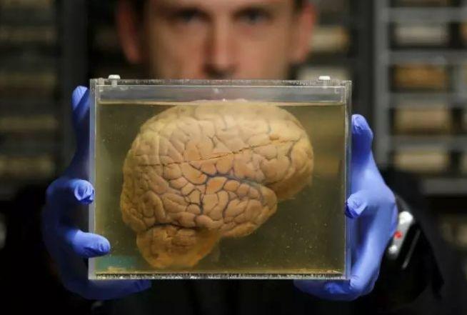 泡在培养皿中的人造大脑居然偷偷向外界发出脑电