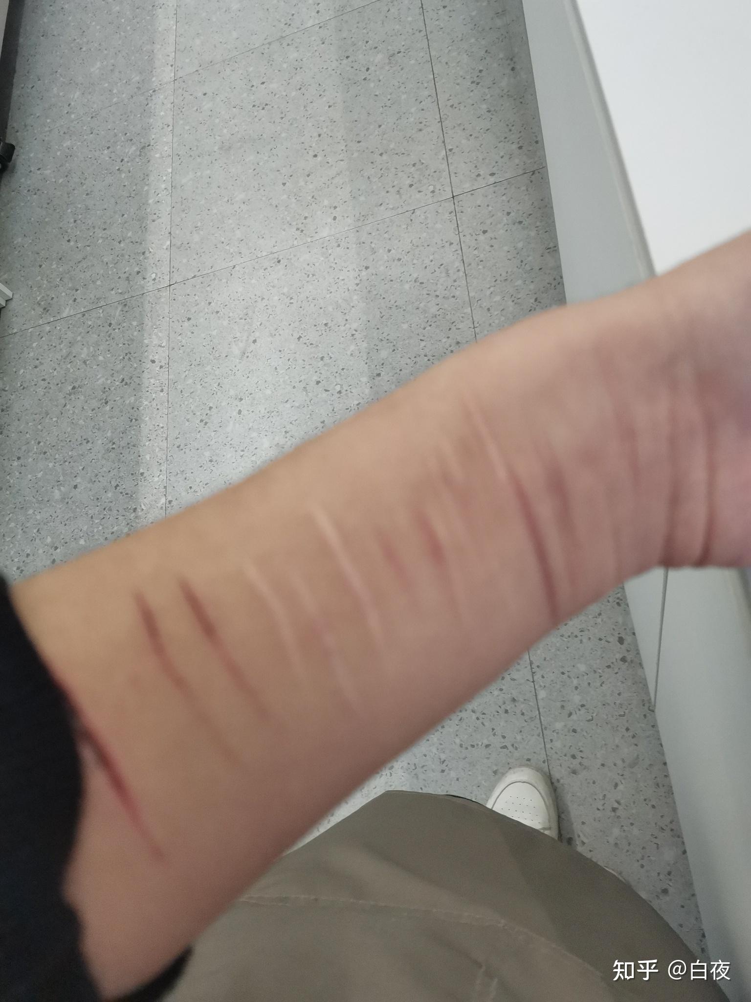 对于一个割腕过的人,未来如何向别人解释这道疤的由来?
