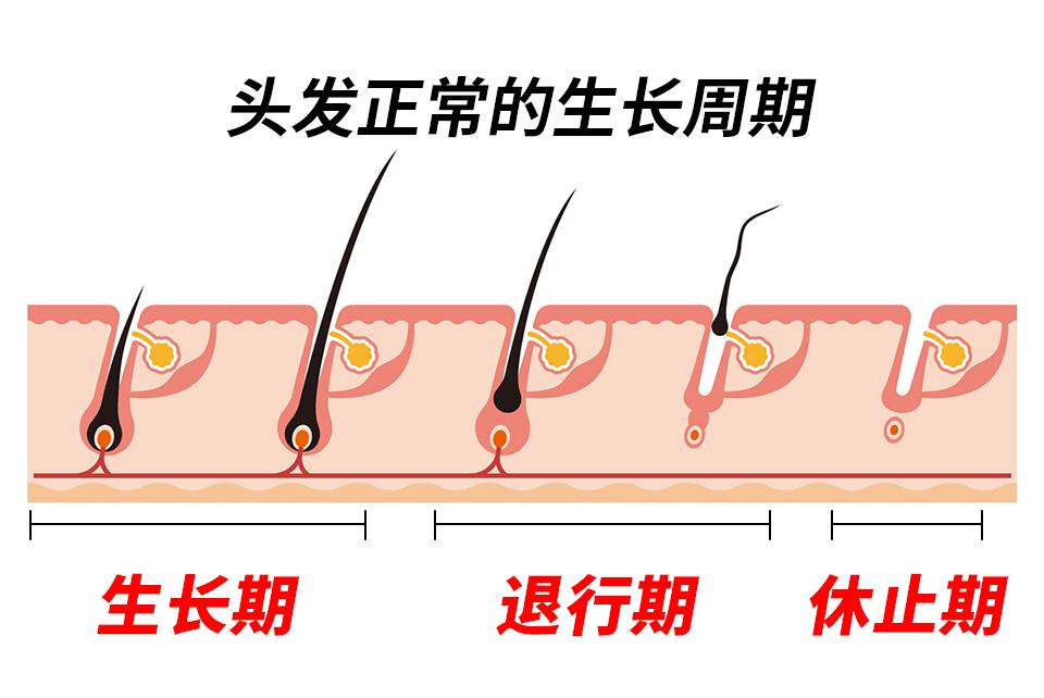 脱发,头发生长缓慢?千万不要扰乱头发的生长周期!