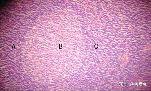 图10-6淋巴小结(淋巴结 he染色10×10) 图示浅层皮质内的淋巴小结为