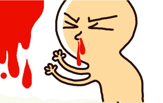 处理鼻出血相信很多人没做对