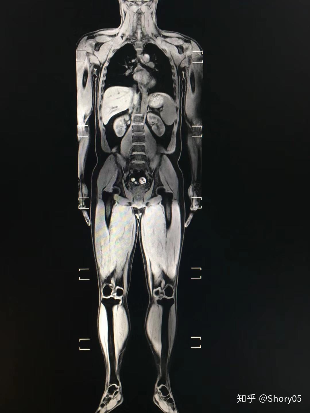 ct能拍出哪些人体结构? - 知乎