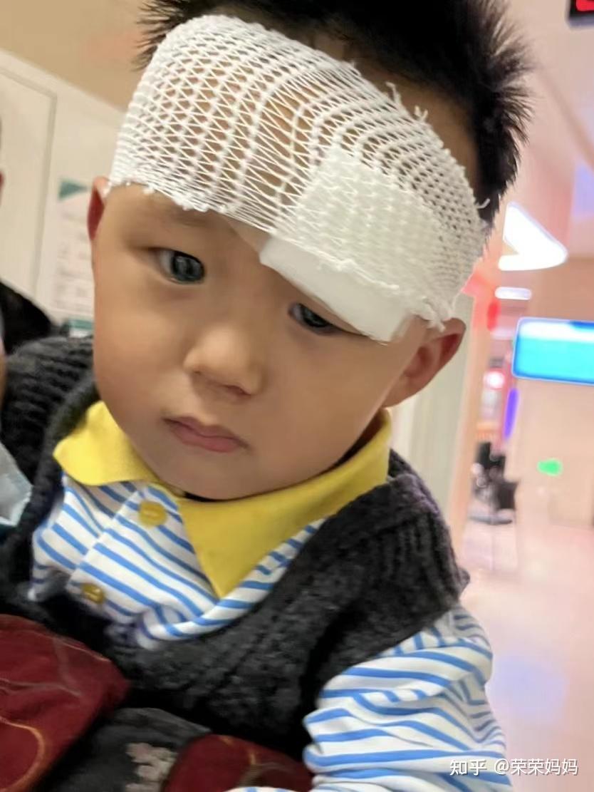 这玩意谁发明的!宝宝磕伤缝针真的不留疤! - 知乎