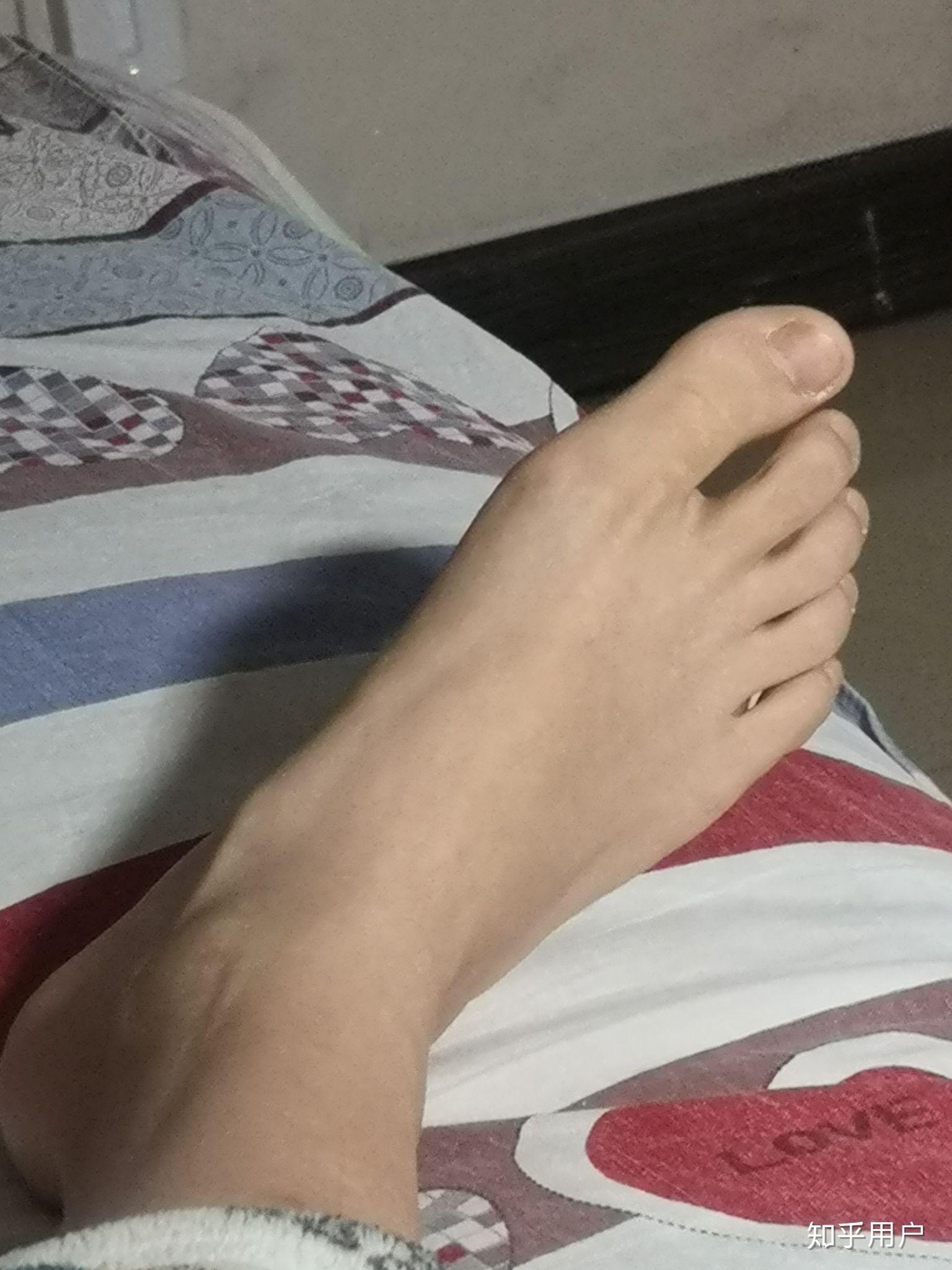 我是个严重的裸脚控兼手控你觉得什么样的脚才算漂亮呢