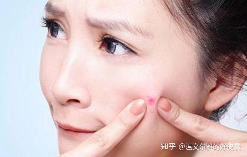 为什么你会长丘疹性痤疮?