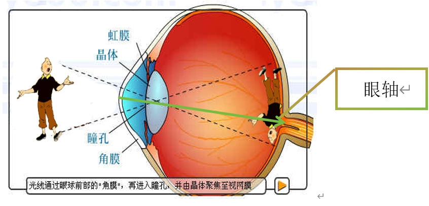 眼轴、眼轴？让你读懂眼科专业术语！ - 知乎
