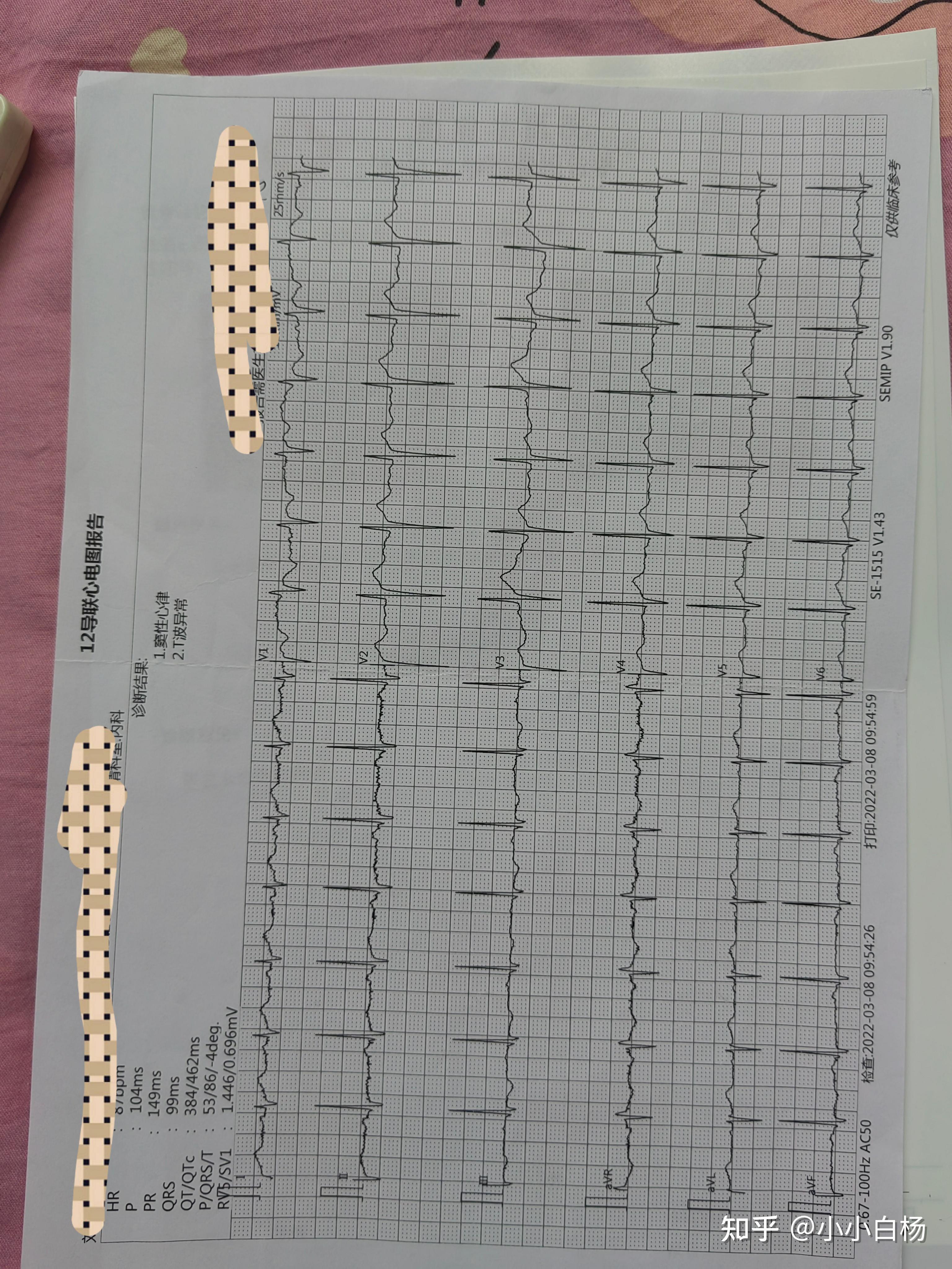 卵圆孔未闭合必须要手术吗?