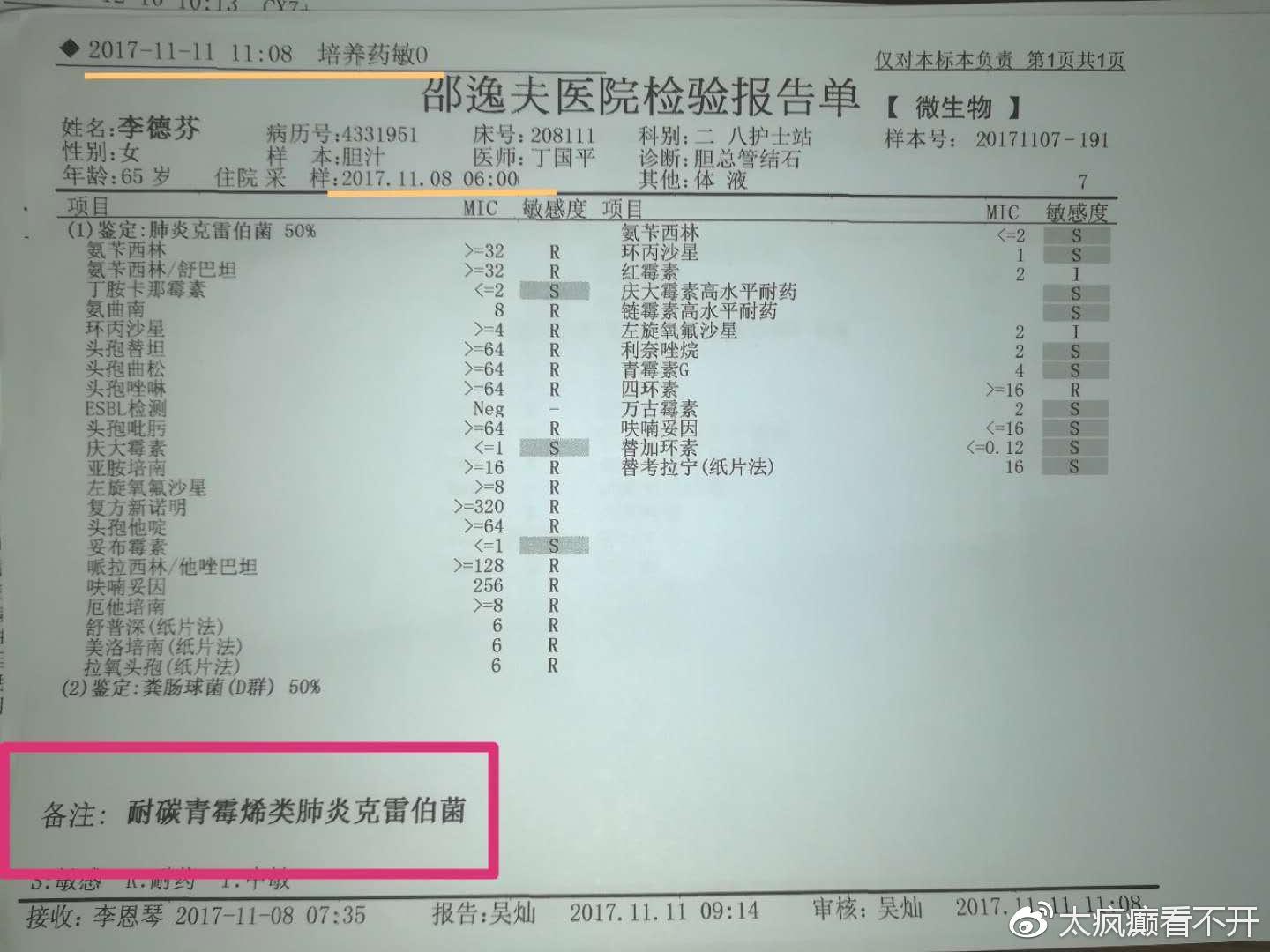 胆结石化验单图片