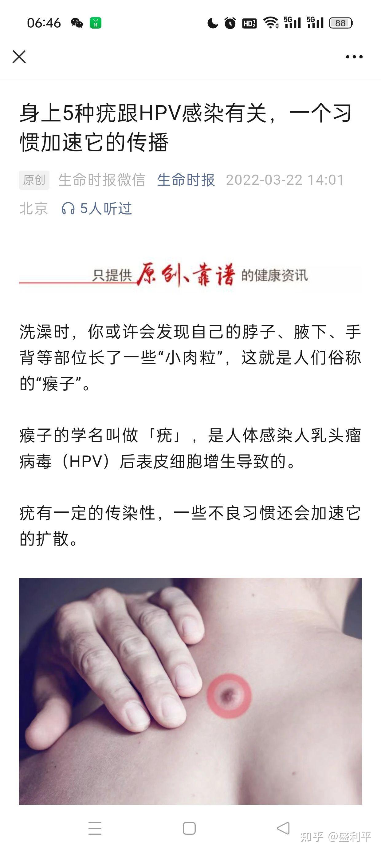 传染性软疣通过什么方式传染的应该怎么治疗