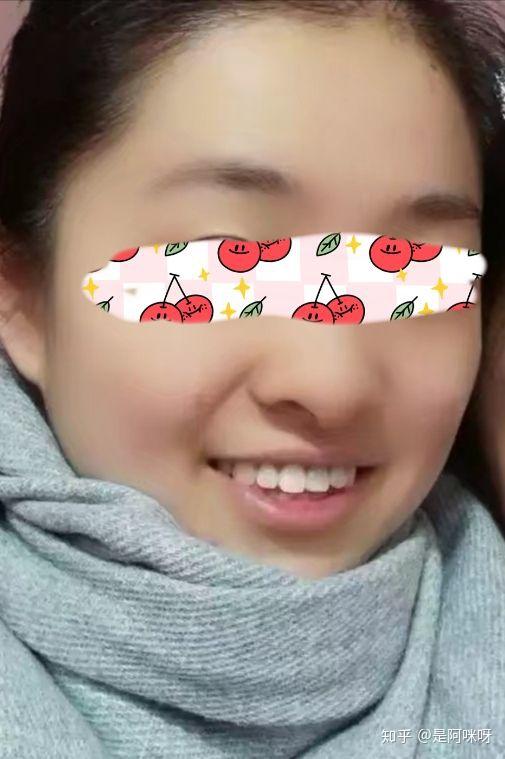 我的门牙渡劫史脱牙再植烤瓷牙种植牙还有三颗智齿客串演出