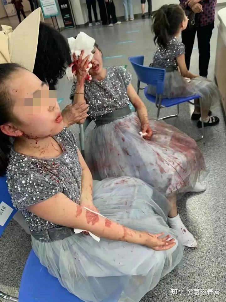 南通学生大巴与渣土车相撞致8伤的原因研判