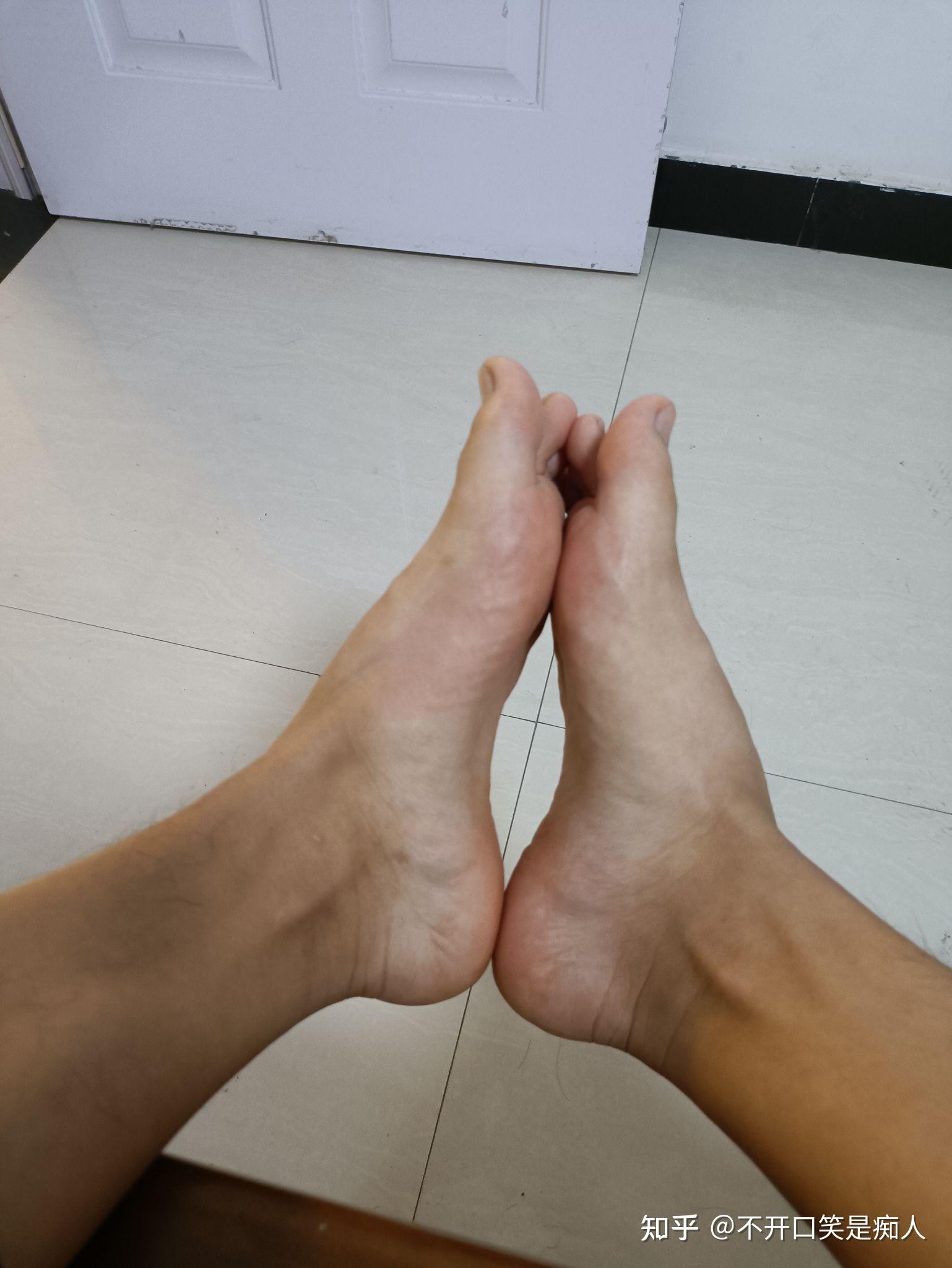 请问我这个是高足弓还是正常足弓鞋子后跟外侧有磨损