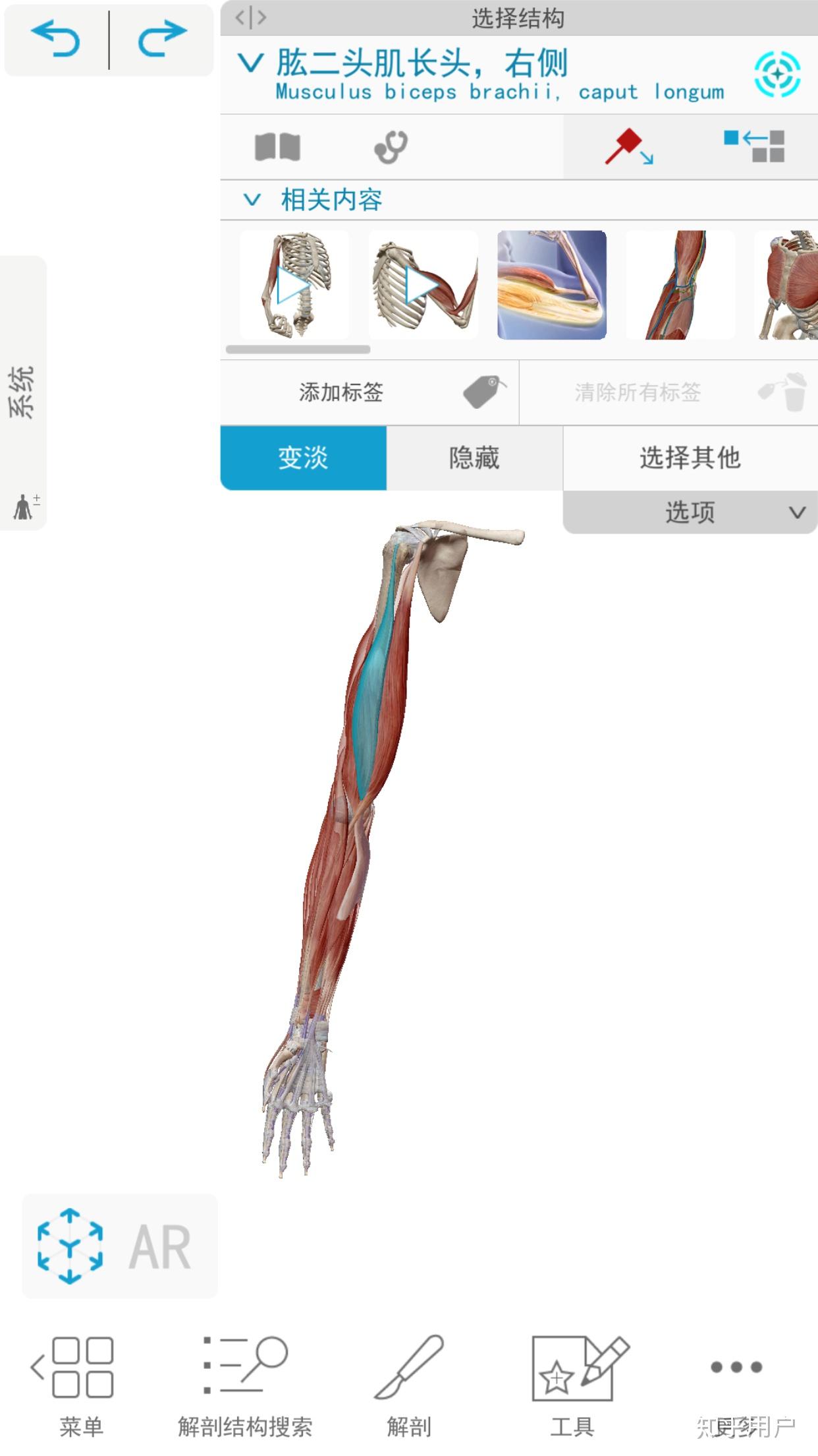 上臂血管通路：肱动脉浅表化加头静脉-肱动脉内瘘 - 知乎