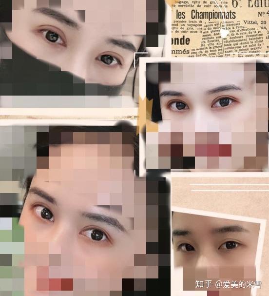 他从事整形行业有20多30年时间,手术案例超过3万台,雪姐今天翻他案例