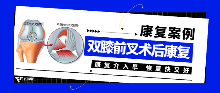 双膝前叉韧带术后康复案例|E .T康复 - 知乎