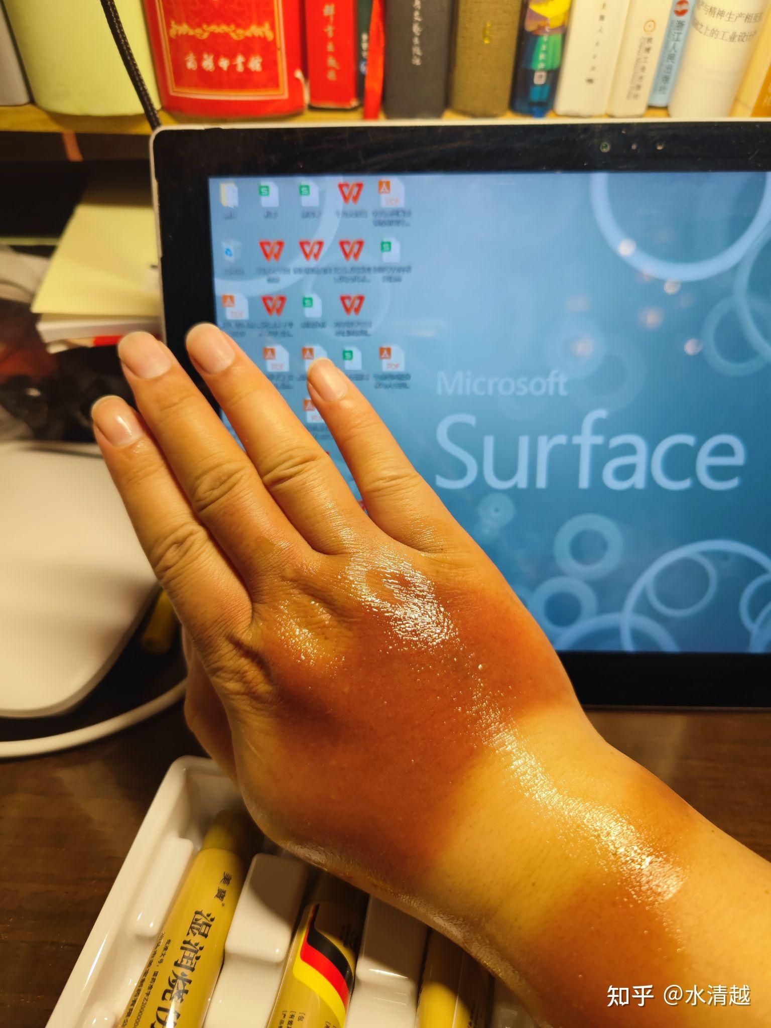 晒伤了啥症状?我这样算晒伤吗