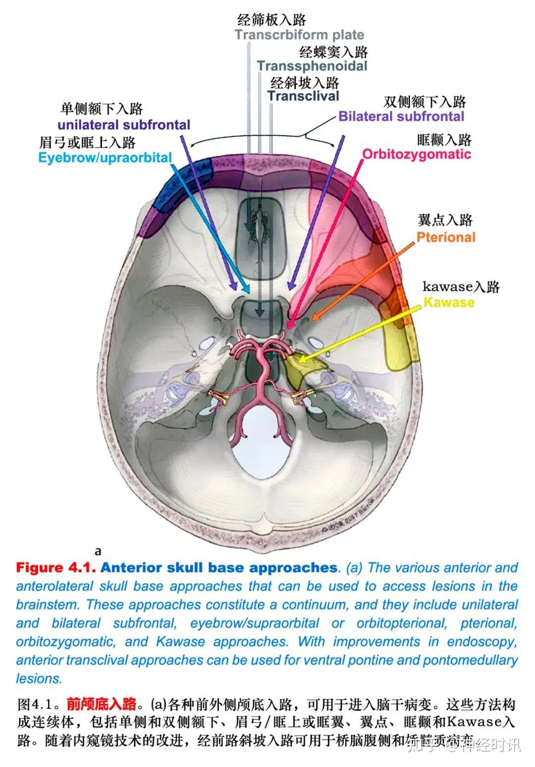 神经外科手术入路总结图|路组图|手术|综合|后颅窝|总结|-健康界