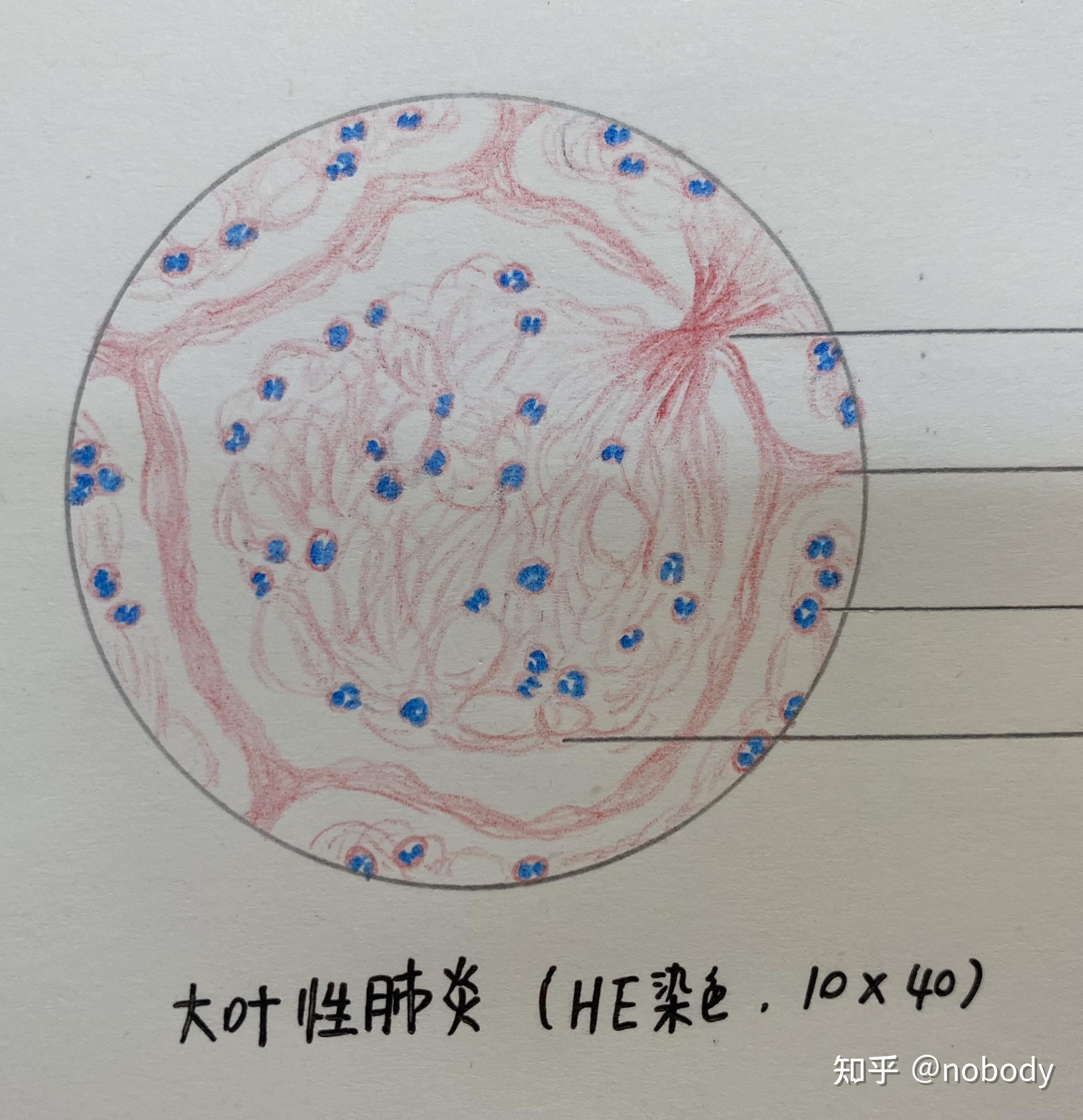 7门脉性肝硬化8慢性肾小球肾炎9