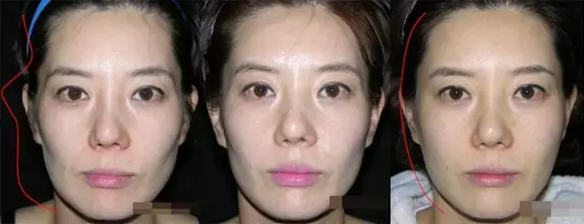 丰太阳穴开运夫妻宫打造贵气之相